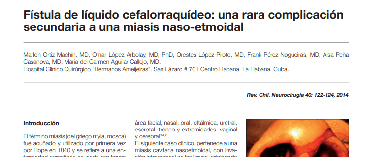 Fístula De Líquido Cefalorraquídeo: Una Rara Complicaciónsecundaria A Una Miasis&nbsp;Naso-etmoidal